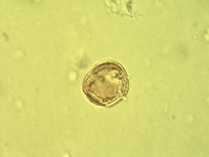 Pollen from the plant Genus Asteropeia.