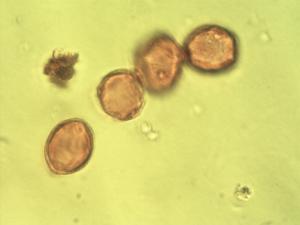 Hymenocardia pollen