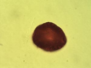 Bussea massaiensis pollen
