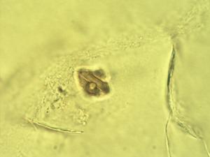 Flacourtia indica pollen