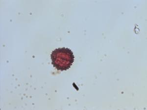 Chromolaena glaberrima pollen