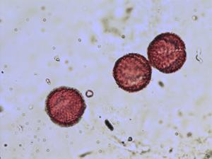 Ranunculus aquatilis pollen