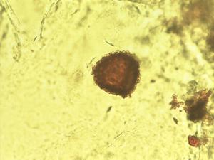 Paraceterach pollen