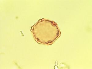 Nothofagus fusca pollen