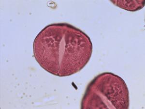 Asphodelus albus pollen