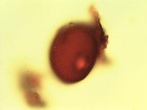 Pyrostria pollen