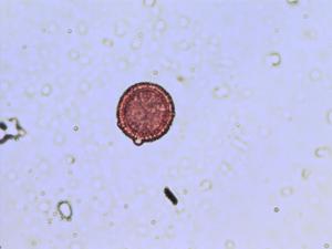 Thymelaea pollen