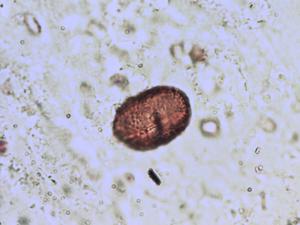 Trifolium striatum pollen
