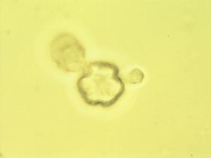 Pollen from the plant Genus Withania.