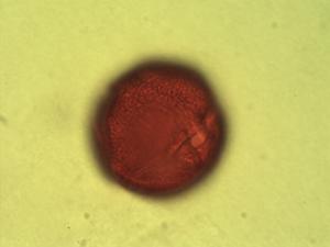 Erythroxylum emarginatum pollen