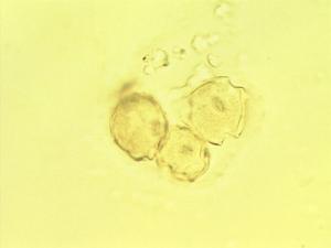 Gomphia pollen