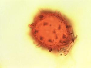 Pollen from the plant Genus Barteria.