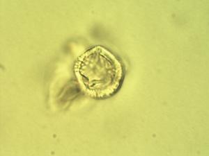 Pollen from the plant Genus Catha.