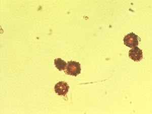 Andryala pinnatifida pollen