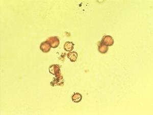 Sambucus palmensis pollen