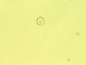 Vallea stipularis pollen