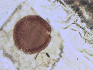 Erodium cicutarium pollen