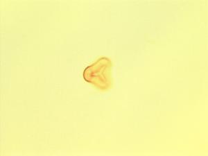 Microlepia speluncae pollen