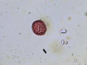 Ranunculus nigrescens pollen
