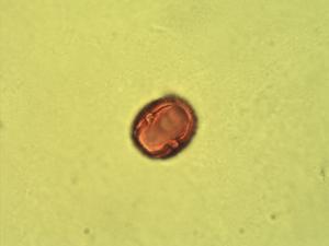 Pollen from the plant Genus Casearia.
