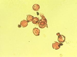 Genista canariensis pollen