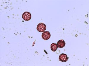 Beta vulgaris pollen