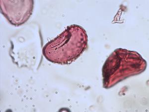 Cystopteris fragilis pollen
