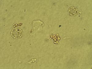 Alternanthera snodgrassii pollen