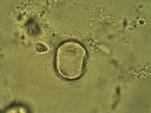 Deschampsia pollen