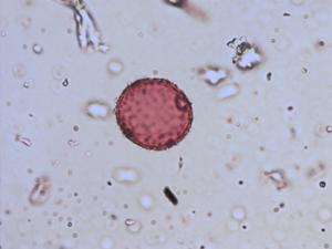 Phyteuma hemisphaericum pollen