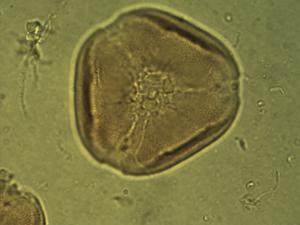 Pollen from the plant Genus Canavalia.