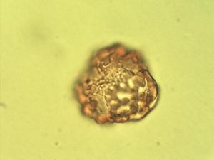 Brachystegia spiciformis pollen