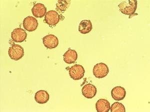Ranunculus cortusifolius pollen
