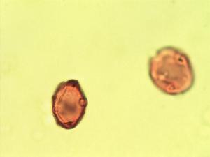Pollen from the plant Genus Betula.
