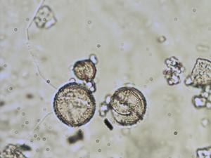 Anemone nemorosa pollen