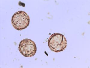 Rumex obtusifolius pollen