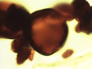 Pollen from the plant Genus Dioclea.