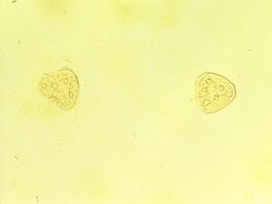 Cyathea weatherbyana pollen