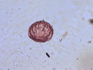 Pollen from the plant Genus Utricularia.