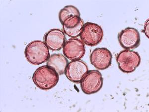 Glaucium corniculatum pollen
