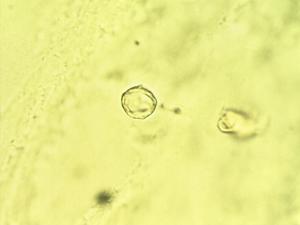 Pollen from the plant Genus Caldcluvia.