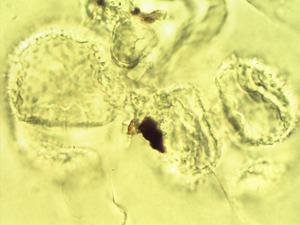 Drosera uniflora pollen