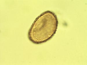Nephrolepis biserrata pollen