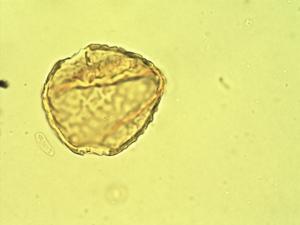Erythrina velutina pollen