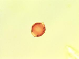 Irvingia tenuinucleata pollen