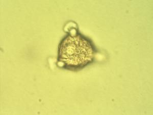 Polycardia phyllanthoides pollen