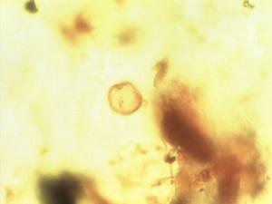 Sterculia tragacantha pollen