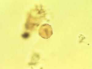 Embelia pollen