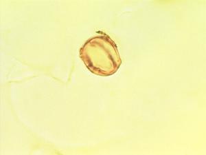 Pollen from the plant Genus Cadia.