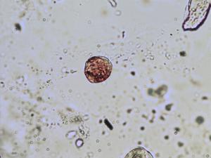 Erophila verna pollen